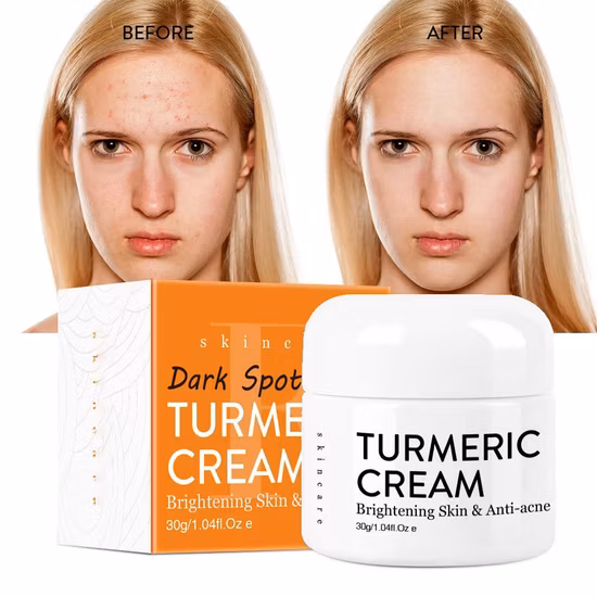 Ailke Face Dark Spot Removal Brightening Set Soins de la peau Crème blanchissante pour le visage